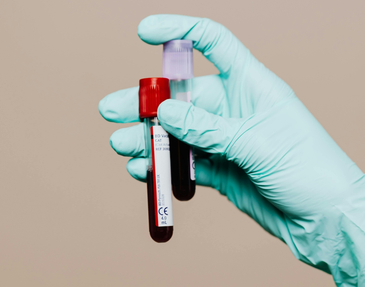 phlebotomy https://halohealth.info/wp-content/uploads/2025/11/phlebotomy.jpg